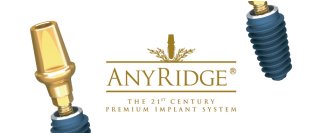 имплант any ridge