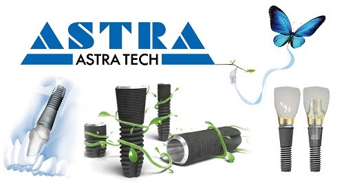 имплант astra tech