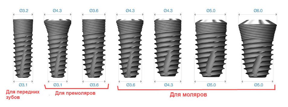 osstem